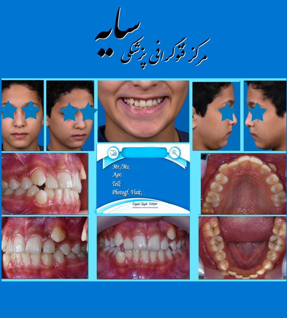 عکاسی پزشکی سایه در لاهیجان